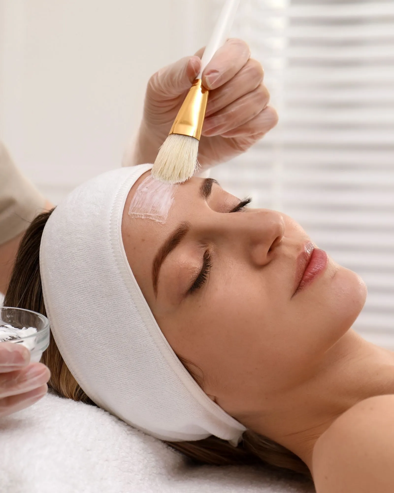 Fruchtsäurepeeling: Ein Peeling wird mit einem Pinsel gleichmäßig auf die Stirn aufgetragen.